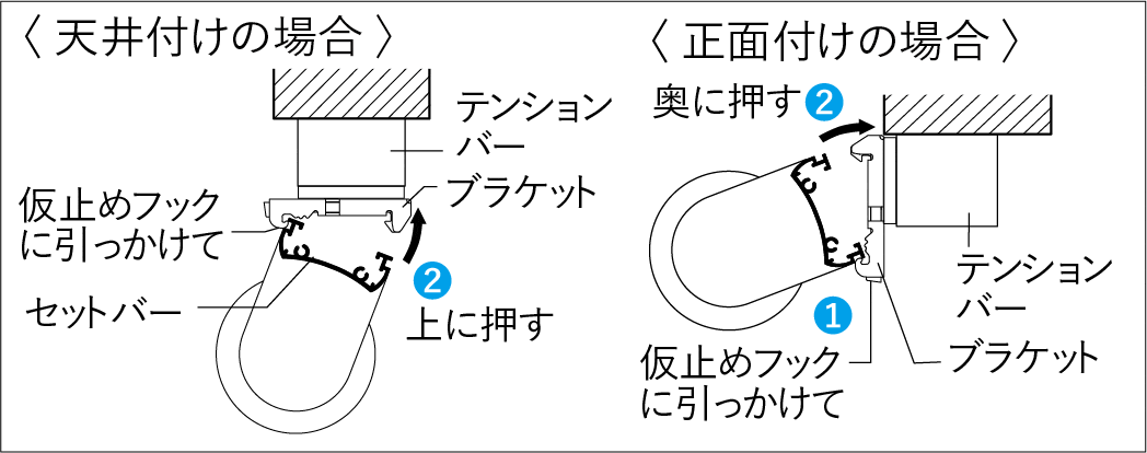 テンションバー